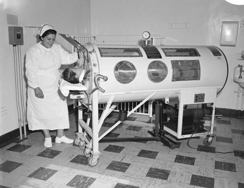 An iron lung in use on a patient with polio in the 1960s