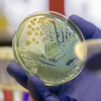 Microorganism on agar plate