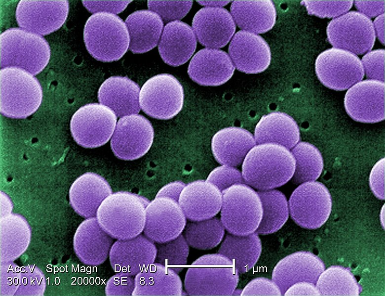 Staphylococcus aureus bacteria shown under scanning electron micrograph
