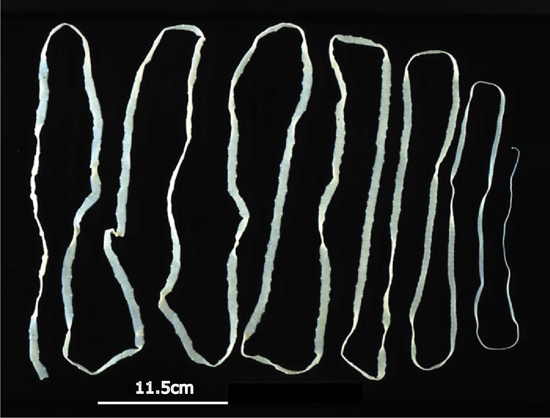 Tape Worm Length Scale